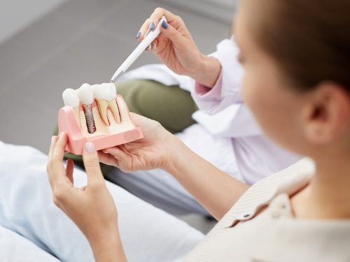 Dentist showing a model of a dental implant to a patient