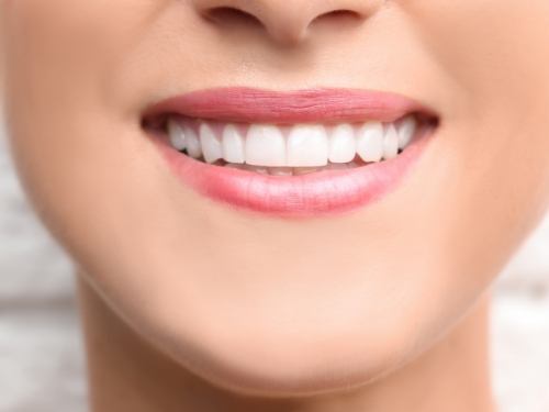 Close up of smile with straight white teeth